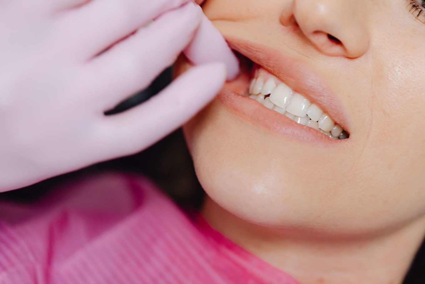 Dental Inlays And Onlays