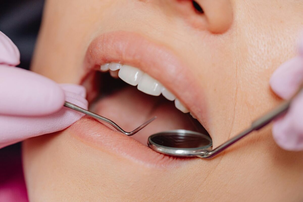 what is in laughing gas