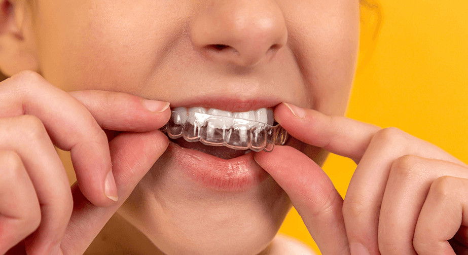 Invisalign headaches