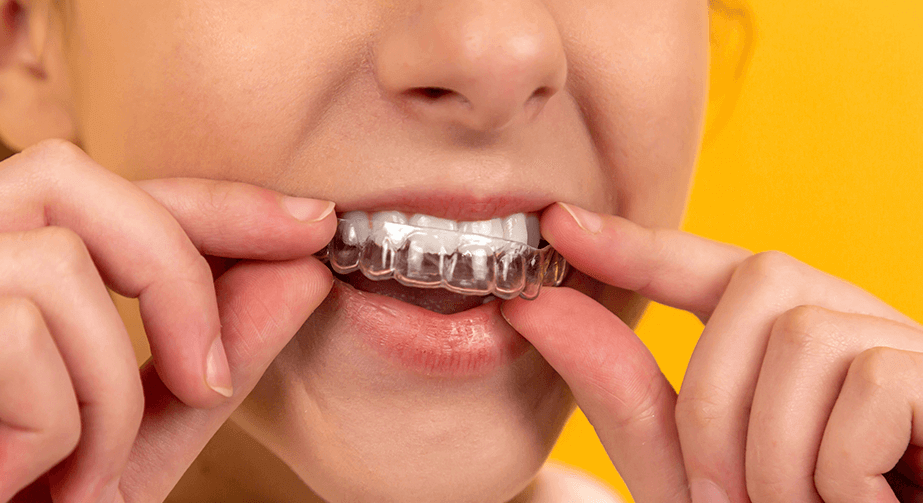 how long are invisalign treatments