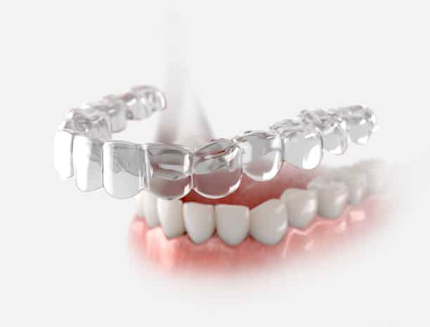how long are invisalign treatments