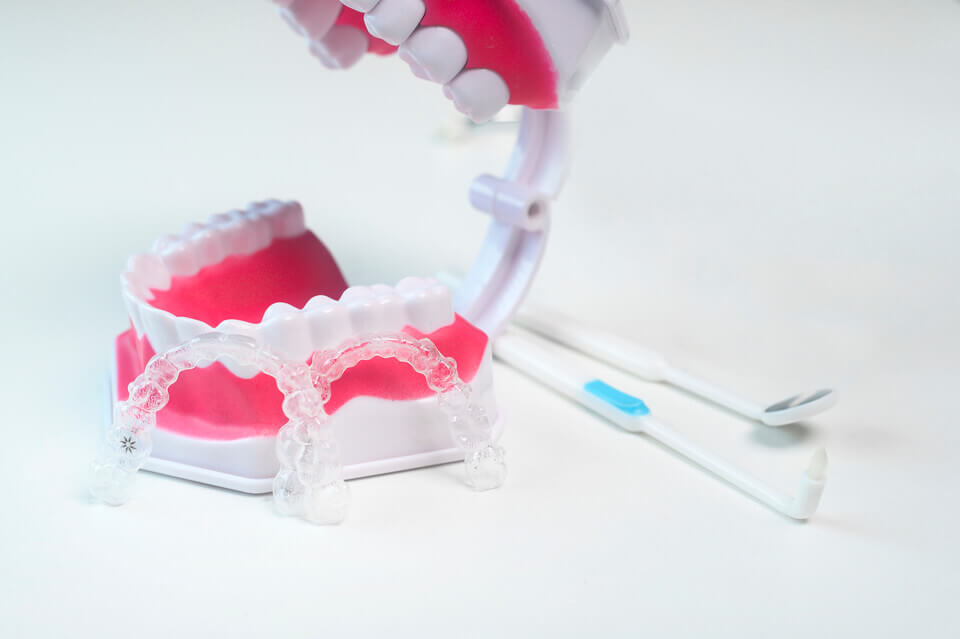 is invisalign better than braces