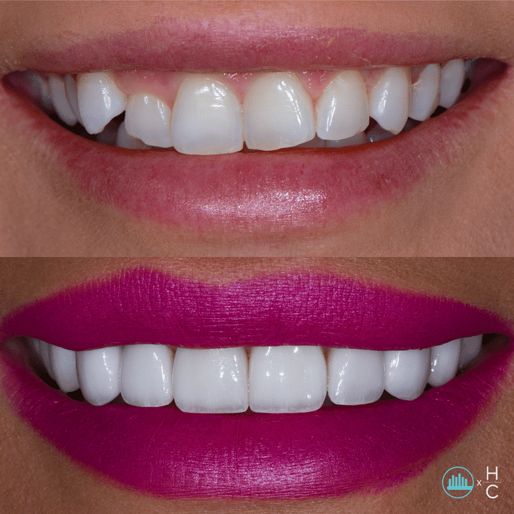chicago cosmetic dentistry