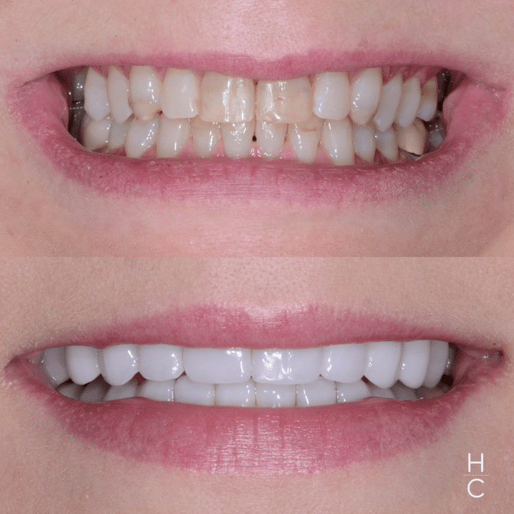 best cosmetic dentist chicago