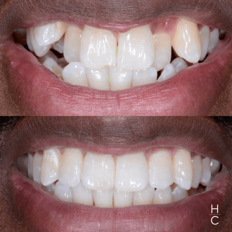 cosmetic dentists chicago il