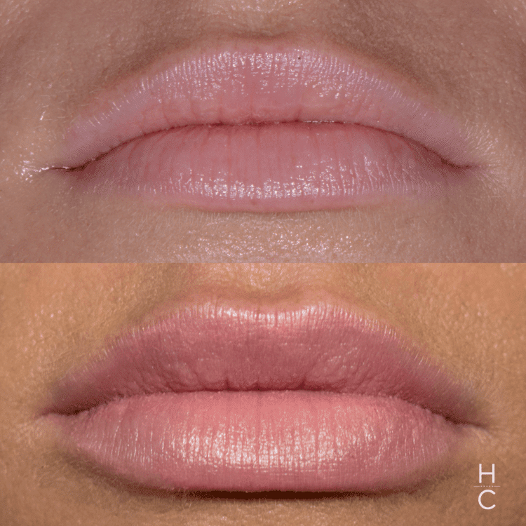 best chicago cosmetic dentist