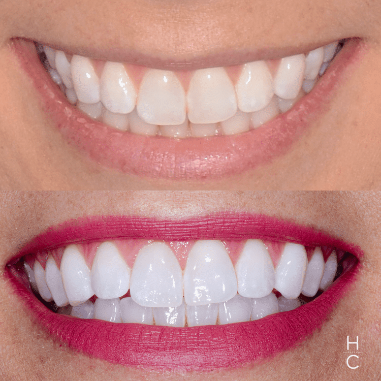 chicago cosmetic dentist