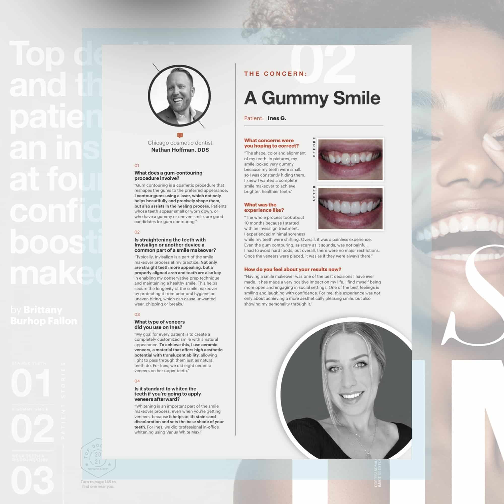 chicago cosmetic dentistry with Nathan Hoffman at Chicago Dental