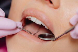 cosmetic dentistry treatments
